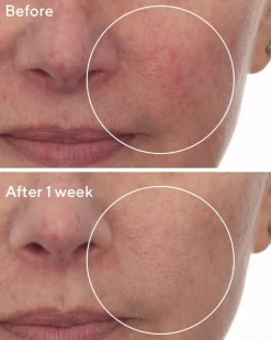 Cellular Hydration Repair Serum, 30 ml