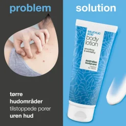 Salicylic Acid Body Lotion, 200 ml