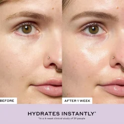 Strength Aprés-Skin Rich Rescue Treatment, 75 ml